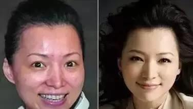 做美容与不做美容的差距