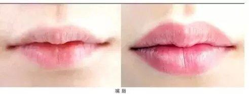 半永久化妆是微整形吗？两者有(yǒu)什么區(qū)别？